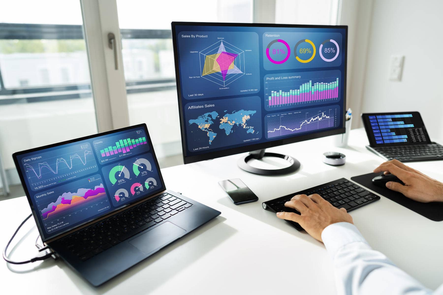 ERP System Schnittstellen